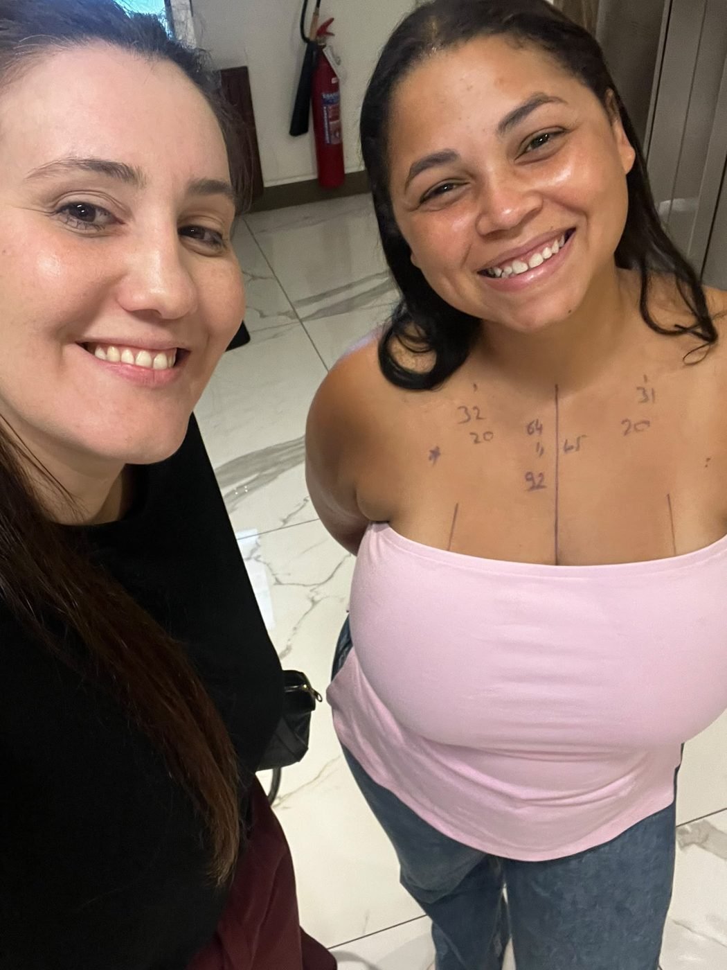 Paciente com a assistente antes da cirurgia mamária