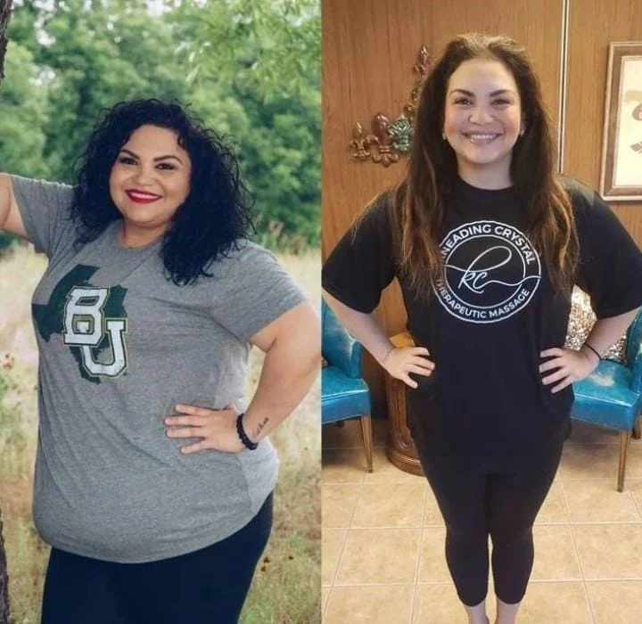 Paciente antes e depois da perda de peso