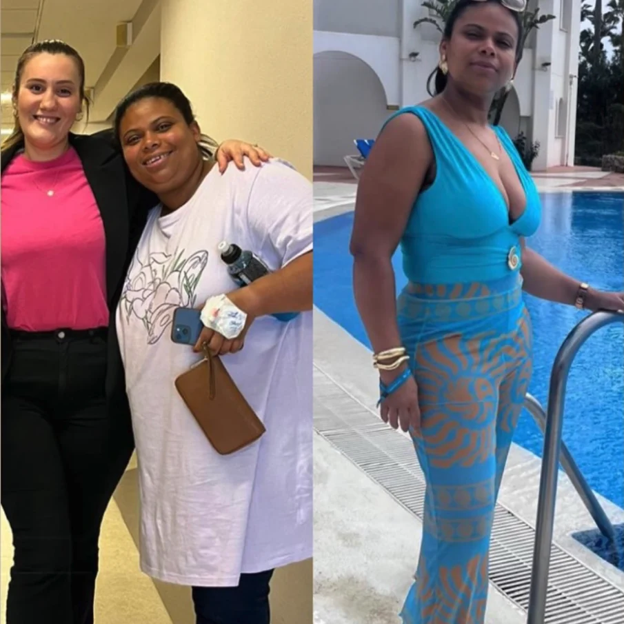 Paciente com a assistente no hospital e depois da perda de peso